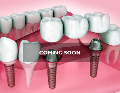 Dental Crown
