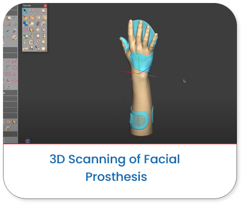 Modelling of Handsplint