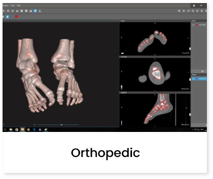 Orthopedic