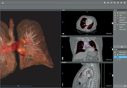 Dicom to Print