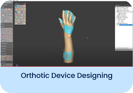 Handsplint Design