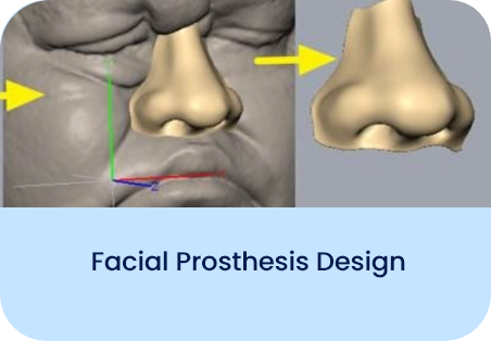 Facial Prosthesis