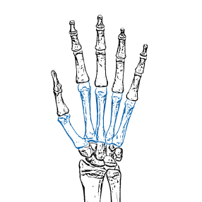 Metacarpal(Hand)
