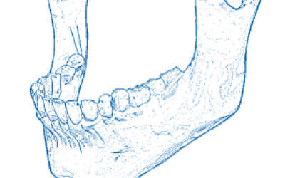 Rectangle 11
