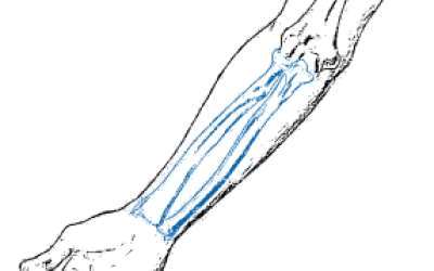 Rectangle 12